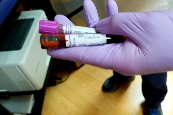 7 CDC requirements of ice pack for the vaccine cold chain you should know 7 CDC requirements of ice pack for the vaccine cold chain you should know